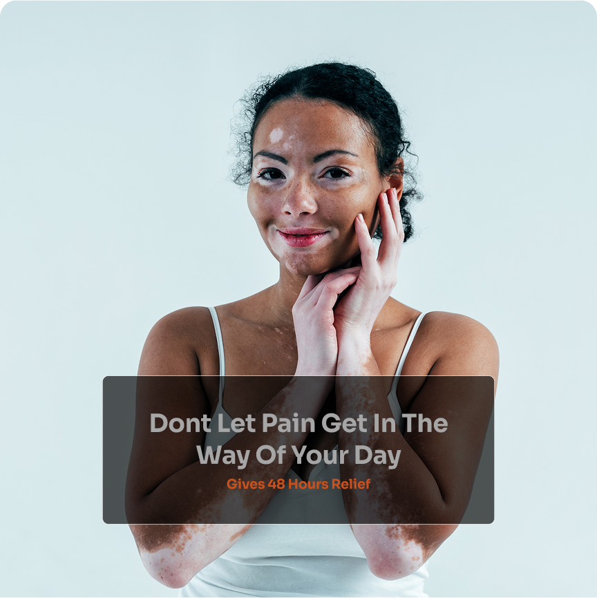 VitoDerm Cream - Image 2