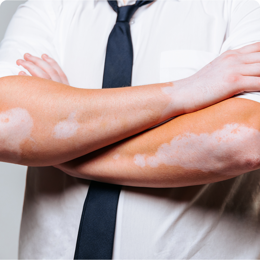 VitoDerm Cream - Image 3