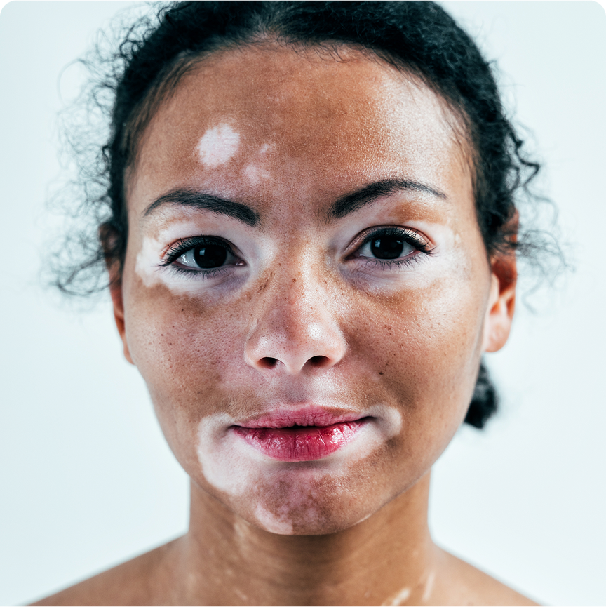 VitoDerm Cream - Image 5